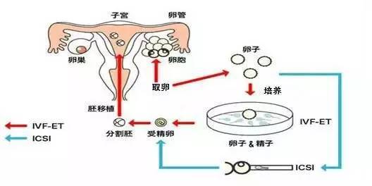 重庆试管婴儿